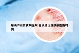 慈溪浒山皮肤病医院 慈溪浒山皮肤病医院时间