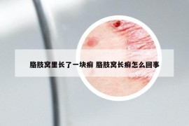 胳肢窝里长了一块癣 胳肢窝长癣怎么回事
