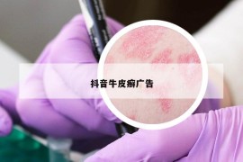 抖音牛皮癣广告