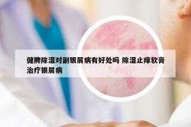 健脾除湿对副银屑病有好处吗 除湿止痒软膏治疗银屑病