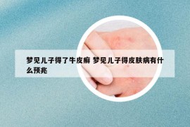 梦见儿子得了牛皮癣 梦见儿子得皮肤病有什么预兆