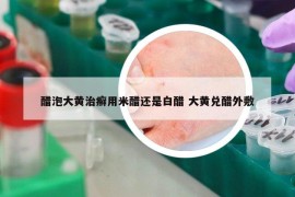 醋泡大黄治癣用米醋还是白醋 大黄兑醋外敷