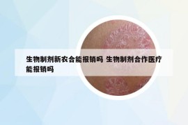 生物制剂新农合能报销吗 生物制剂合作医疗能报销吗