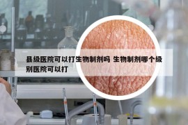 县级医院可以打生物制剂吗 生物制剂哪个级别医院可以打