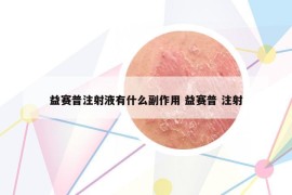 益赛普注射液有什么副作用 益赛普 注射