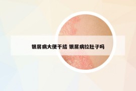 银屑病大便干结 银屑病拉肚子吗
