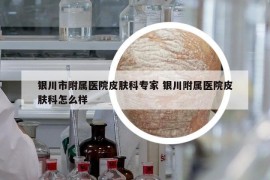 银川市附属医院皮肤科专家 银川附属医院皮肤科怎么样