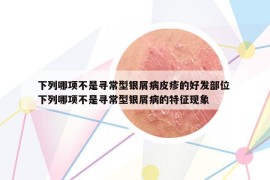 下列哪项不是寻常型银屑病皮疹的好发部位 下列哪项不是寻常型银屑病的特征现象