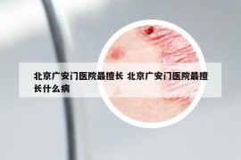 北京广安门医院最擅长 北京广安门医院最擅长什么病