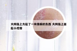 大拇指上方起了一块像癣的东西 大拇指上面起小疙瘩