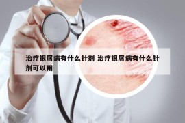 治疗银屑病有什么针剂 治疗银屑病有什么针剂可以用