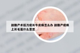 剖腹产术后刀疤长牛皮癣怎么办 剖腹产疤痕上长毛是什么意思