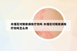 木槿花对银屑病有疗效吗 木槿花对银屑病有疗效吗怎么养