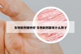 生物制剂哪种好 生物制剂都有什么牌子