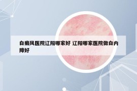 白癜风医院辽阳哪家好 辽阳哪家医院做白内障好