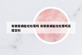 有银屑病能吃松茸吗 有银屑病能吃松茸吗百度百科