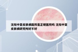 沈阳中亚皮肤病医院是正规医院吗 沈阳中亚皮肤病研究所好不好