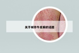 关于城市牛皮癣的话题
