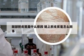 腿部脱皮屑是什么原因 腿上脱皮屑是怎么回事