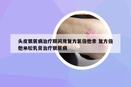 头皮银屑病治疗期间用复方氯倍他索 复方倍他米松乳膏治疗银屑病