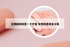 生物制剂利恩一个疗程 生物剂恩利多少钱
