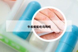 牛皮癣能吃乌鸡吗