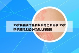 15岁男孩两个胳膊长癣是怎么回事 15岁孩子胳膊上起小红点儿的原因