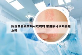陈皮生姜银屑病可以喝吗 银屑病可以喝姜糖水吗