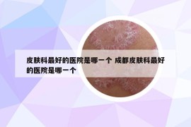 皮肤科最好的医院是哪一个 成都皮肤科最好的医院是哪一个