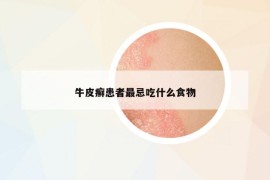 牛皮癣患者最忌吃什么食物