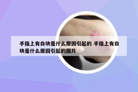 手指上有白块是什么原因引起的 手指上有白块是什么原因引起的图片