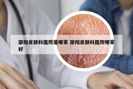 邵阳皮肤科医院是哪家 邵阳皮肤科医院哪家好