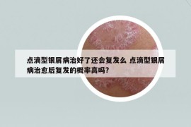 点滴型银屑病治好了还会复发么 点滴型银屑病治愈后复发的概率高吗?