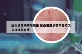济南银屑病医院费用 济南银屑病医院费用怎么样博润在线