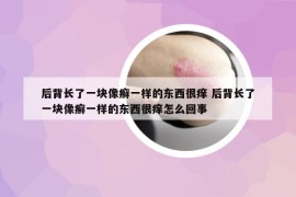 后背长了一块像癣一样的东西很痒 后背长了一块像癣一样的东西很痒怎么回事