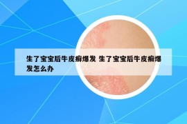 生了宝宝后牛皮癣爆发 生了宝宝后牛皮癣爆发怎么办