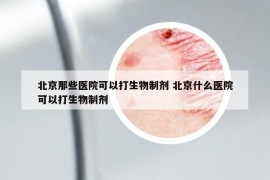 北京那些医院可以打生物制剂 北京什么医院可以打生物制剂