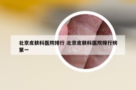北京皮肤科医院排行 北京皮肤科医院排行榜第一