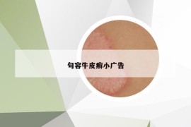 句容牛皮癣小广告