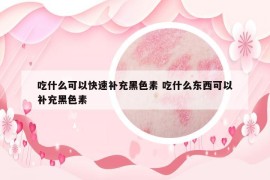 吃什么可以快速补充黑色素 吃什么东西可以补充黑色素