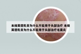 本维莫德乳膏为什么不能用于头部治疗 本维莫德乳膏为什么不能用于头部治疗毛囊炎