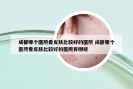 成都哪个医院看皮肤比较好的医院 成都哪个医院看皮肤比较好的医院有哪些