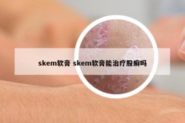 skem软膏 skem软膏能治疗股癣吗