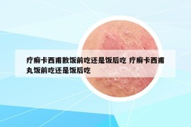 疗癣卡西甫散饭前吃还是饭后吃 疗癣卡西甫丸饭前吃还是饭后吃