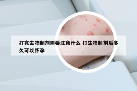 打完生物制剂需要注意什么 打生物制剂后多久可以怀孕