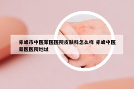 赤峰市中医蒙医医院皮肤科怎么样 赤峰中医蒙医医院地址
