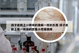 孩子皮肤上一块块的像癣一样的东西 孩子皮肤上有一块块的密集小疙瘩很痒