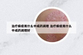 治疗癣症用什么中成药调理 治疗癣症用什么中成药调理好