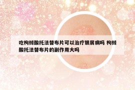 吃枸橼酸托法替布片可以治疗银屑病吗 枸橼酸托法替布片的副作用大吗