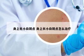 身上长小白斑点 身上长小白斑点怎么治疗